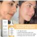 Glycolic Acid 7% Toning Solution Glycolic Acid Toner Hydrating Toner Glycolic Acid Serum Improve Blemishes&Acne and Spots Anti Aging Exfoliating Toner for Face Toner for Oily Skin 100ml - Buy Online on SooperMarket.com