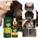 Ginger Oil Hair Growth Natural Hair Density Essential Oil Skin 100% Pure Essential Oil Aromatherapy Repair Skin Hair Growth Oil Strengthens Hair (Ginger 30 ml) B - Buy Online on SooperMarket.com