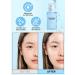 I DEW CARE Hydra Vibes 10-Hyaluronic Acid Serum | Moisturizing Korean Vegan Skin Care | Jeju Hydrangea | Glass Skin Glow | 30ml - Buy Online on SooperMarket.com