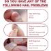 Instant Nail Repair Gel - Nail Strengthener and Hardener for Broken Nails - 8ml - Buy Online on SooperMarket.com