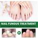 MrCuvaryas Nail Serum for Toenails Extra Strong - Buy Online on SooperMarket.com