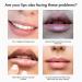 Silicone Lip Scrub Brush | Exfoliating Double-Sided Lip Scrubber Tool | Smoother & Fuller Lips | 3 Colors, 3 PCS - Buy Online on SooperMarket.com
