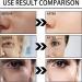 Serum Instant Effect Face Face Serum Plumping Skin Hydrating Serum Instant Face Tightening Facial Essence Anti-Aging Serum Skin Lightening Serum Dark Eye Circle Wrinkle Remover - Buy Online on SooperMarket.com