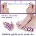 Sibba 2 Pairs Gel Toe Separators for Overlapping Toes, Bunions, Hammer Toe - Foot Pain Relief | Style A - Buy Online on SooperMarket.com