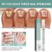4-Piece Nail Care Pen Set with Tea Tree Oil Vitamin E & Aloe Vera - Well-Groomed Fingernails & Toenails - Includes Nail File - Green - Buy Online on SooperMarket.com