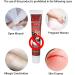 Maximum Strength Aloe Cream for Swelling & Discomfort Relief - Fissure Ointment - Buy Online on SooperMarket.com