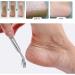Foot Care Tool Kit with Foot Scrubber Scraper Foot Care Tools for Perfect Foot Care and Pedicure Foot Rasp Kit for Dead Hard Skin - Buy Online on SooperMarket.com