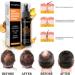 Trendyfave Hair Regrowth Spray Hair Growth Serum Thickening Hair Volume Spray Anti Hair Loss Spray Hair Rapid Growth Spray Natural Ingredients Hair Regrowth Serum Repair Hair Follicles -30ML - Buy Online on SooperMarket.com