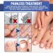 NailPro Nail Fungus LED Light Therapy Device Nail Fungus Laser Nail Fungus Treatment Home Use Nail-Fungus Remover for Toenail Fingernails & Onychomycosis (A01) - Buy Online on SooperMarket.com