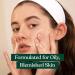 The Body Shop Tea Tree Foaming Cleanser - Purifying Face Wash for Oily, Blemished Skin (5 oz) | Vegan Friendly - Buy Online on SooperMarket.com