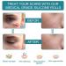 Medical Grade Silicone Scar Tape Roll (1.6 x 60) for Scar Removal - Professional Silicone Strips for Surgery, C-Section, Acne, Burn and Keloid - Safe & Reusable - 1.5M - Buy Online on SooperMarket.com