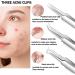 Pimple Popper Tool Kit - 15PCS Blackhead Remover & Extraction Tools for Estheticians - Buy Online on SooperMarket.com