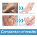 Foot Cream For Very Dry Feet Natural Foot Cream Foot Cream For Calluses And Hard Skin Cracked Heel Repair Balm Coconut Oil Foot Moisturiser Callus Remover Soften For Feet Knees Hand - 50g - Buy Online on SooperMarket.com