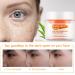 Dark Skin Peeling Oil and Dark Spot Correcting Cream - Extra Strength Exfoliating Solution - Buy Online on SooperMarket.com
