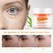 Dark Spot Remover for Face & Body - Niacinamide Aloe Vitamin E | Even Skin Tone Cream 1.76OZ - Buy Online on SooperMarket.com