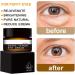 Snake Venom Eye Cream - Anti Wrinkle Eye Cream For Puffiness + Wrinkles Brightening Under Eye Cream Diminishing Deep Wrinkles Dark Circle Eye Cream Eye Bag Treatment For Men And Women 30g - Buy Online on SooperMarket.com