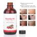 Rosehip Oil 118 ml - Natural Anti-Aging Moisturizing Massage & Spa Essential Oil for Aromatherapy - Buy Online on SooperMarket.com