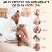 LightenUp Skin Brightening Lotion 13.5 Fl oz - Hyperpigmentation Body Cream with Jamaican Castor Oil and Shea Butter - Buy Online on SooperMarket.com