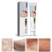 Face Cream Body Cream Anti-Itch Cream Chinese Herbal Cream Skin Repairing Cream for Face Body Cream for Itchy Skin Moisturizing Skin Cream 20 g