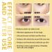 Rollerball Castor Oil & Frankincense Eye Roller | Reduce Dark Circles & Bags Under Eyes - International Shipping - Buy Online on SooperMarket.com