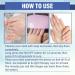 NailPro Nail Fungus LED Light Therapy Device Nail Fungus Laser Nail Fungus Treatment Home Use Nail-Fungus Remover for Toenail Fingernails & Onychomycosis (A01) - Buy Online on SooperMarket.com