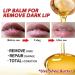 Lip Lightening For Dark Lips Moisturizing Lip Balm Whitening & Brightening Lip Balm Lips Pink Bleaching Cream Balm Lip Care Lightens Remove Dark Lips (1PC) - Buy Online on SooperMarket.com