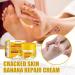 Anti-Dry Skin Foot Cream | Nourishing Moisturizer for Dry Feet - A Size | International Shipping Available - Buy Online on SooperMarket.com