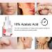 Azelaic Acid Serum 10% - Redness Relief & Skin Balance | Hyaluronic Acid Facial Serum - 0.5oz for All Skin Types - Buy Online on SooperMarket.com