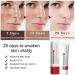 Age Spot Remover for Face Dark Spot Remover for Face & Body Spot Cream Dark Spot Corrector Freckle Remover Cream Hyperpigmentation Treatment Formulated with Nicotinamide Vitamin E Glycerol - Buy Online on SooperMarket.com