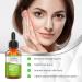 Buy Mabox Facial Serum with Vitamin B3 Niacinamide - Reduce Pore Size Tightens Skin Fights Acne & Fades Blemishes - Deep Hydration (1 Fl Oz) - International Shipping Available - Buy Online on SooperMarket.com