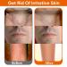 Ingrown Hair Treatment & Razor Bumps Stopper Serum - Alcohol-Free After Shave Solution for Men and Women - Face, Neck, Bikini, Legs, and Underarms - Buy Online on SooperMarket.com