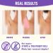 Waxing Kit for Women Men | Painless Hair Removal with Hard Wax Beans | At Home Waxing Kit for Sensitive Skin | Includes Wax Warmer and Applicator Sticks | Ideal for Eyebrow, Armpit, Bikini, Brazilian | All-White - Buy Online on SooperMarket.com