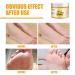 Yuci Banana & Honey-Milk Foot Balm - Repair Cracked Skin & Moisturize Dry Hands/Feet | Anti-Fungal Formula for Rough Skin - Buy Online on SooperMarket.com