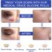 Silicone Scar Sheets 1.6x120 - Scar Removal Tape for Burn, Acne, C-Section & Surgery - Reusable & Washable - Buy Online on SooperMarket.com