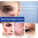 Shark Scar Repair Water 30ml - Moisturizing Scar Removal Liquid for Skin Repair | Color One Size - Buy Online on SooperMarket.com