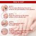 TBeautfave Fungal Nail Treatment Antifungal Nail Treatment Toe Nail Fungal Treatment Fungal Nail Treatment for Toenails Extra Strong Nail Repair and Strengthen Fix & Renew Damaged Broken Nails - Buy Online on SooperMarket.com