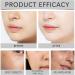 Lactic Acid 10% + HA Face Serum 10% Lactic Acid Serum Dark Spot Remover for Face Lactic Acid Face Moisturiser Pore Minimizer Hydrating Serum for Even Skin Tone Antioxidation Firming - Buy Online on SooperMarket.com