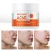 Acne Treatment for Face  Salicylic Acid Acne Cream Back Acne Treatment Cream for Teens & Adults Anti-acne Moisturizer Pimple Cream Butt Acne Clearing Cream  Acne Spot Treatment for Breakouts Blemish