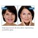 3Pcs Botox Face Serum - Hyaluronic Acid & Vitamin B5 Anti-Aging Solution Fade Fine Lines | International Shipping - Buy Online on SooperMarket.com