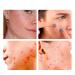 2024 New Acne Cover Patch Spot Stickers for Face & Skin - 36 Patches | Effective Acne Treatment | Fast Shipping Internationally - Buy Online on SooperMarket.com