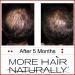 More Hair Naturally 9 - Advanced Stem Cell Therapy for Thinning Hair - Buy Online on SooperMarket.com