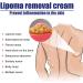 Lipoma Removal Cream 0.7oz | Anti-Inflammatory Cellulite Treatment for Skin | Easy Absorption Formula | Alleviate Lipoma Mass - Buy Online on SooperMarket.com