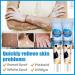 MIELIKKI Vitiligo Cream | Reduce White Spots & Enhance Skin Pigmentation | Natural Vitiligo Care Cream for All Skin Types - Buy Online on SooperMarket.com