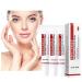 Xing Chen Hai Yang 3Pcs Spot Off Freckle Whitening Cream  Freckle Whitening Cream