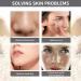 Natural Soothing Cream Skin Repairing Cream for Face Body Natural Face Cream Body Lotion Hydrating Soothing Cream Nourishing Face Moisturiser for Women and Men Anti Wrinkle Moisturiser Face 120ml - Buy Online on SooperMarket.com