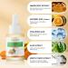 Turmeric Dark Spot Corrector Serum with Vitamin C - 30ml/1oz - Acne & Hyperpigmentation Treatment to Smooth Skin - Buy Online on SooperMarket.com