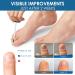 Fungal Nail Treatment Serum Extra Strong Antifungal Nail Treatment for Toenails/Fingernails Improve Thickening/Yellowed/Discolored Nails Original(nail Fungal Serum) - Buy Online on SooperMarket.com