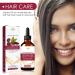 Hair Growth Oil | Jojoba & Wild Oil - Natural Anti-Frizz Density Boost for Men & Women - 30 ml | Aznever - Buy Online on SooperMarket.com