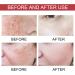 Dark Spot Correcting Serum Peach 70% Niacinamide Serum for Acne Scars Post-Acne Marks Korean Skincare Set for Teenagers Adult - Buy Online on SooperMarket.com