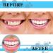 100 Pieces Resin Teeth Veneers for Halloween Cosplay, Scary Theme Party Makeup - Dental Temporary Front and Molar Posterior Teeth for Costume Filling - Buy Online on SooperMarket.com